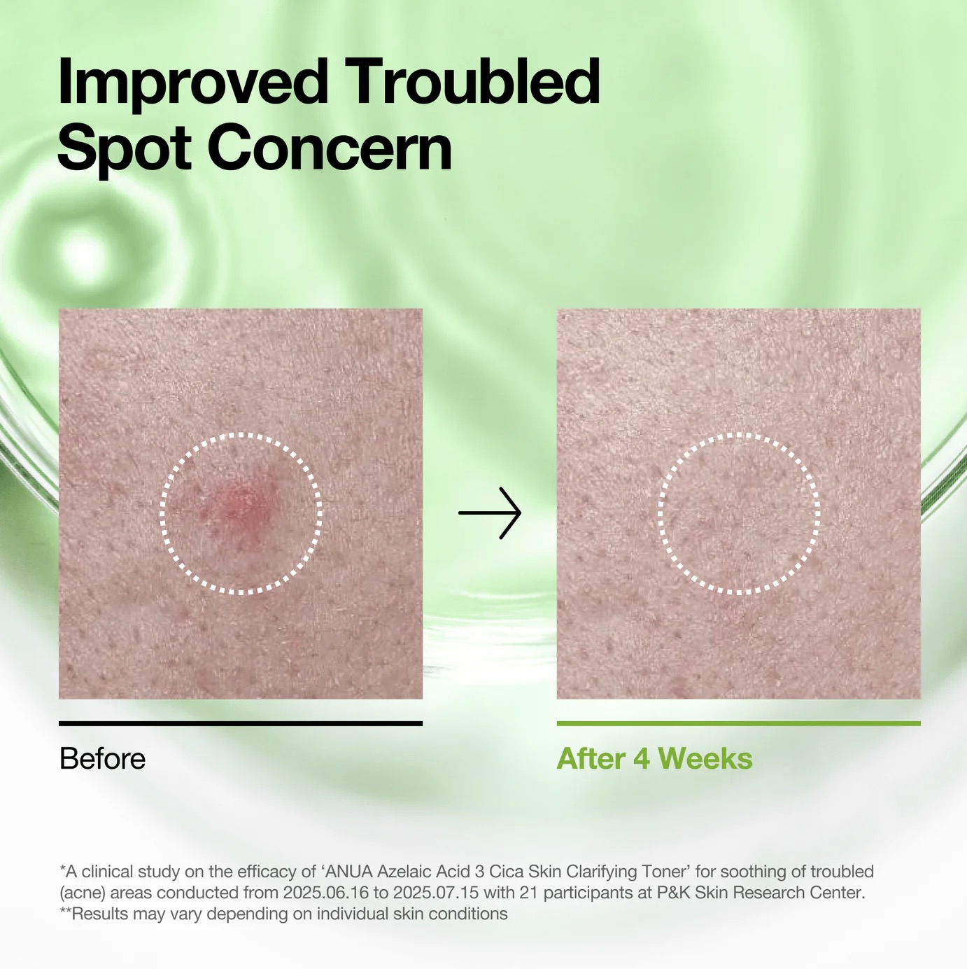 anua-us-toner-azelaic-3-cica-skin-clarifying-toner-1189970121